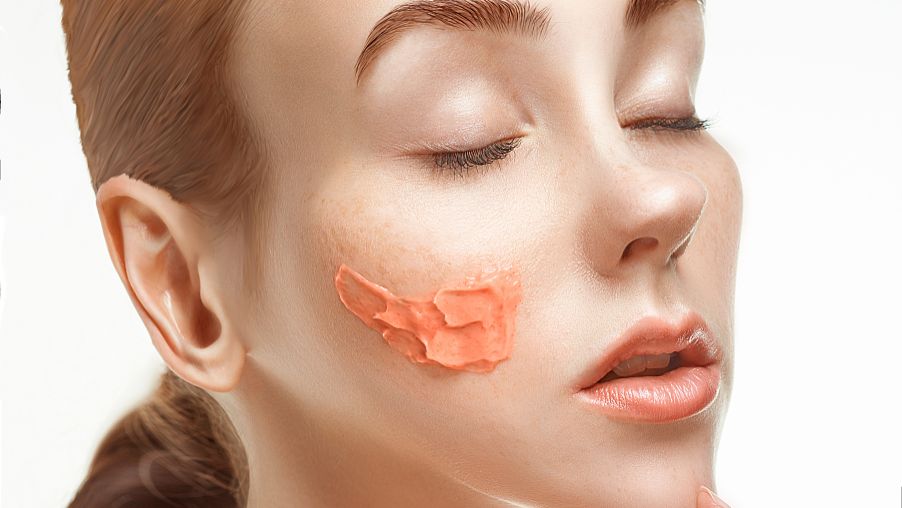 彩光祛斑会有哪些危害？上海希颜整形医院科普