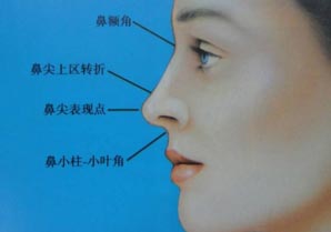 鼻小柱整形效果