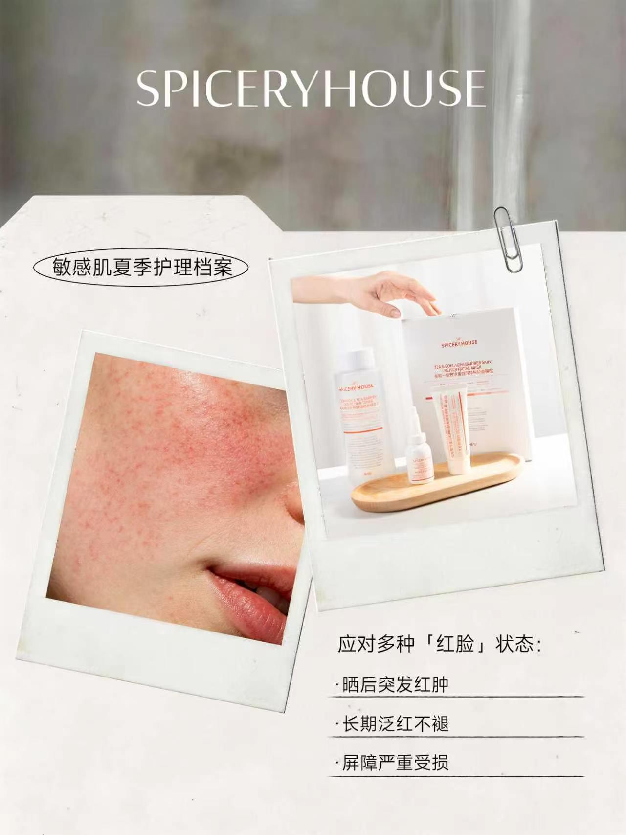 敏感肌夏季护理档案