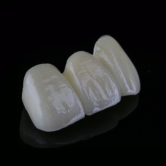 爱尔创全瓷，全锆