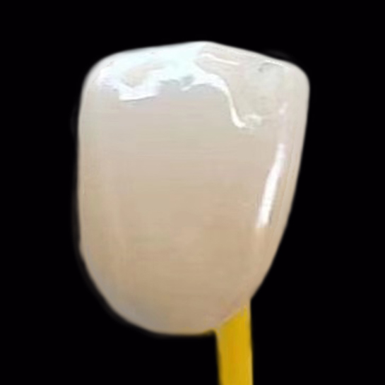 威兰德全瓷，全锆