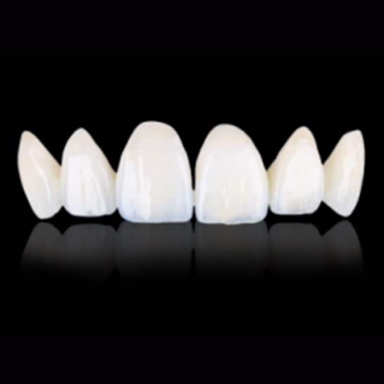 西诺德全瓷，全锆