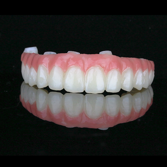 全口种植-氧化锆桥
